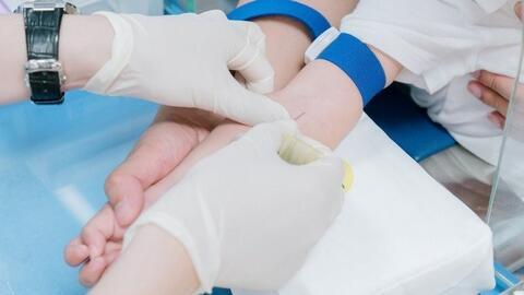 Trẻ táo bón, mẩn ngứa quanh miệng do dị ứng sữa