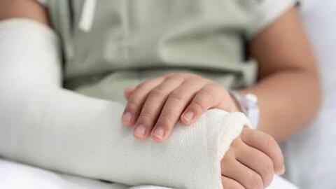 Gãy xương ở trẻ: Hiểm họa rình rập mùa Hè